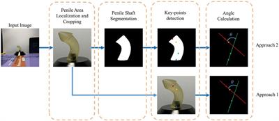Automated measurement of penile curvature using deep learning-based novel quantification method